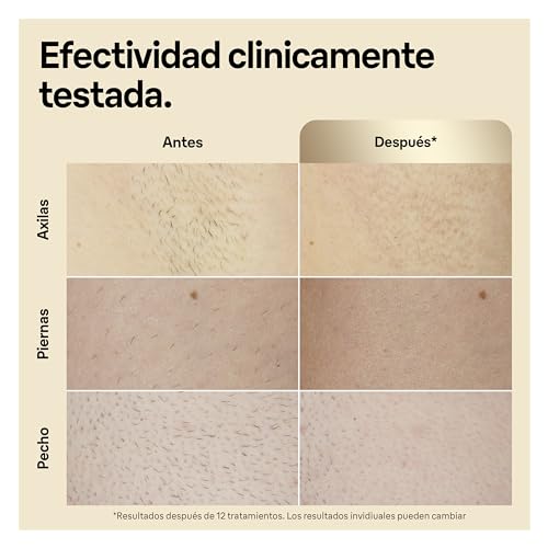 Braun Silk-expert Pro 5 Depiladora Láser Mujer/Hombre Luz Pulsada IPL, Alternativa a la Depilación Láser ,Cabezal de Precisión + Maquinilla de Afeitar Venus, PL5387, Dorada/Blanca