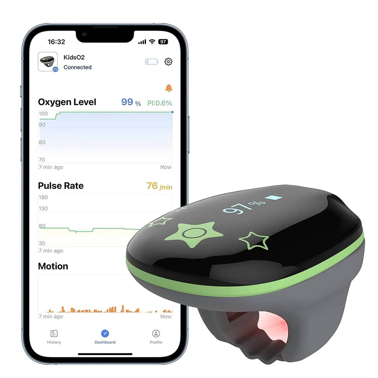 ViATOM Oxímetro de Pulso Pediátrico, Monitor de Oxígeno Para niños que realiza un Seguimiento Continuo de los Niveles de Oxígeno en Sangre de los Niños con Recordatorio de Audio