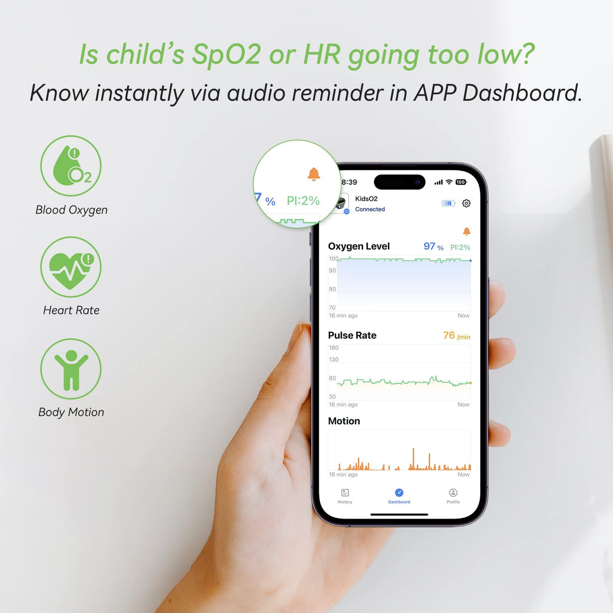 ViATOM Oxímetro de Pulso Pediátrico, Monitor de Oxígeno Para niños que realiza un Seguimiento Continuo de los Niveles de Oxígeno en Sangre de los Niños con Recordatorio de Audio