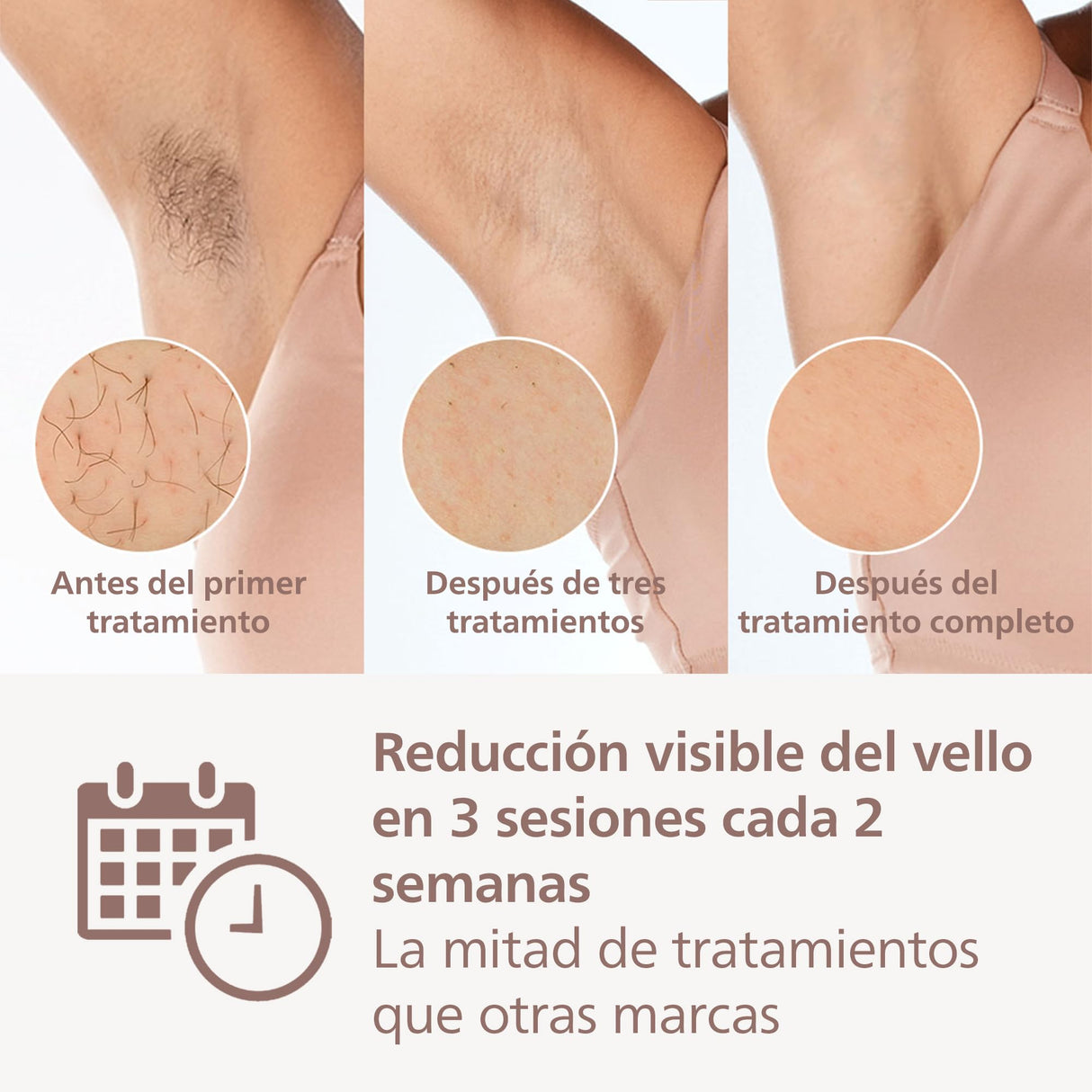 Philips Lumea Serie 9000, Depiladora Luz Pulsada, IPL, Piel Suave Desde Casa, Con Funda, Accesorios para el Cuerpo, Cara, Bikini y Axilas, Sin Cable, Alternativa a Depilación Láser. BRI957/00