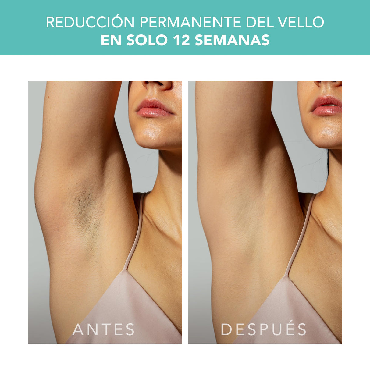 FOREO PEACH 2 IPL, Depiladora Luz Pulsada, Alternativa para Depiladora Laser Mujer, Depiladora Corporal Hombre y Mujer, 10-min de tratamiento, Sistema de Enfriamiento, Cableado, Mint