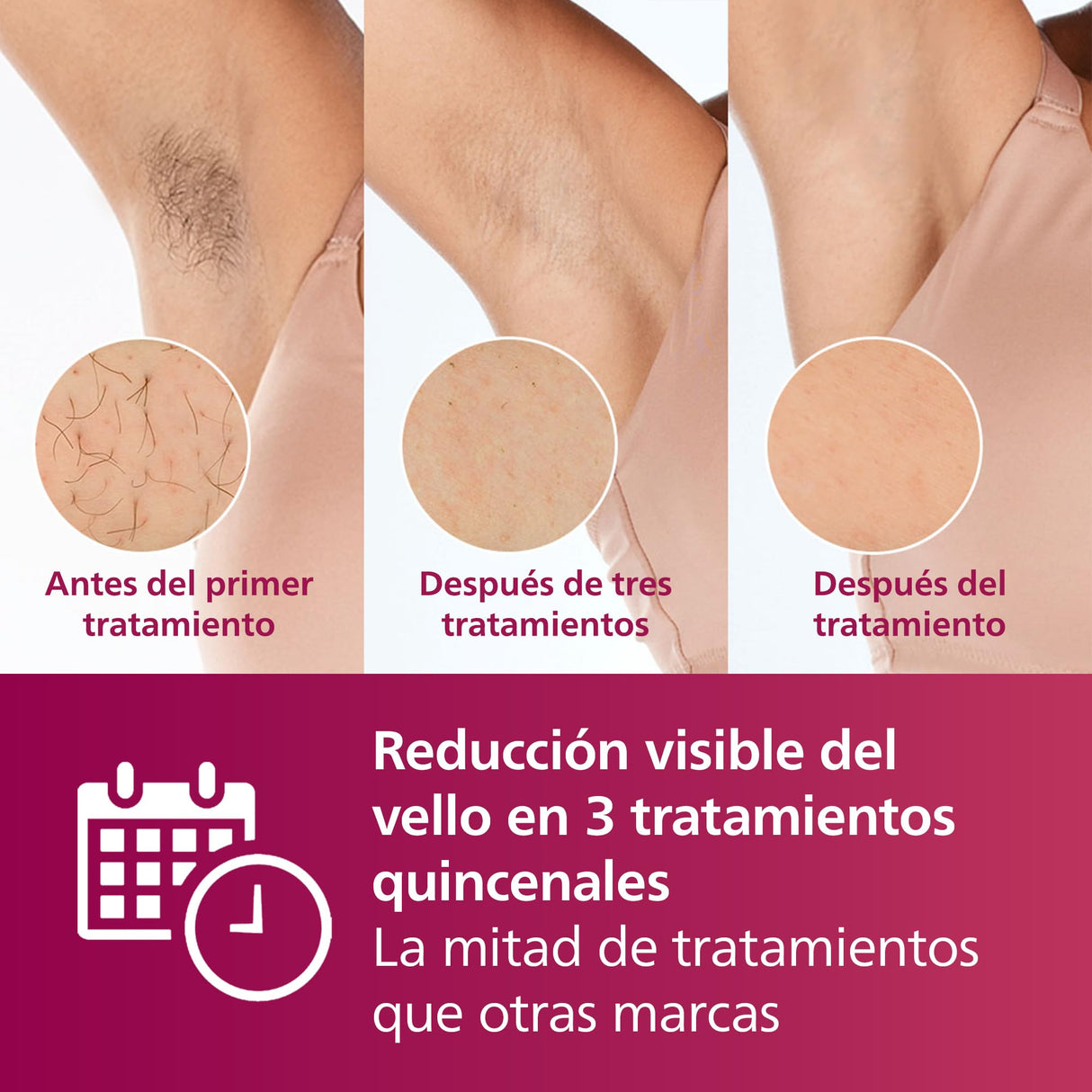Philips Lumea Serie 7000, Depiladora Luz Pulsada, IPL, Piel Suave Desde Casa, Con Funda, Accesorios para el Cuerpo, Cara y Zona del Bikini, Alternativa a Depilación Láser. SC1999/00