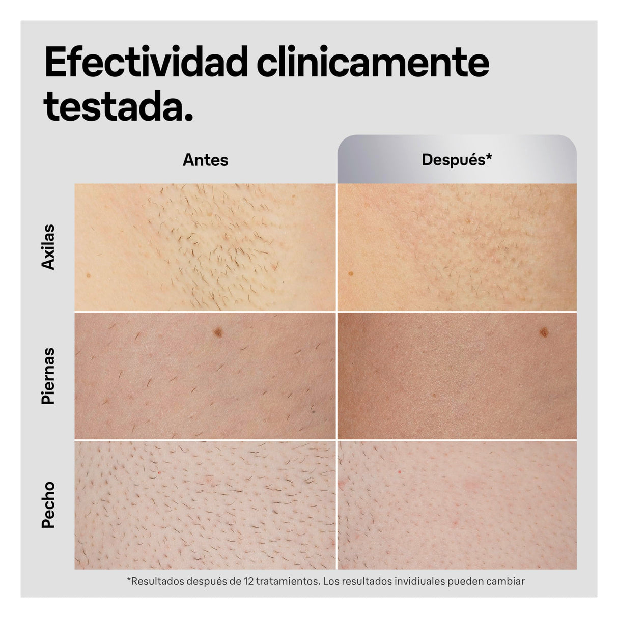 Braun Luz Pulsada Silk-expert Pro 5 PL5145 IPL, Eliminación Del Vello En Casa, Funda, Maquinilla De Afeitar Gillette, 2 Cabezales