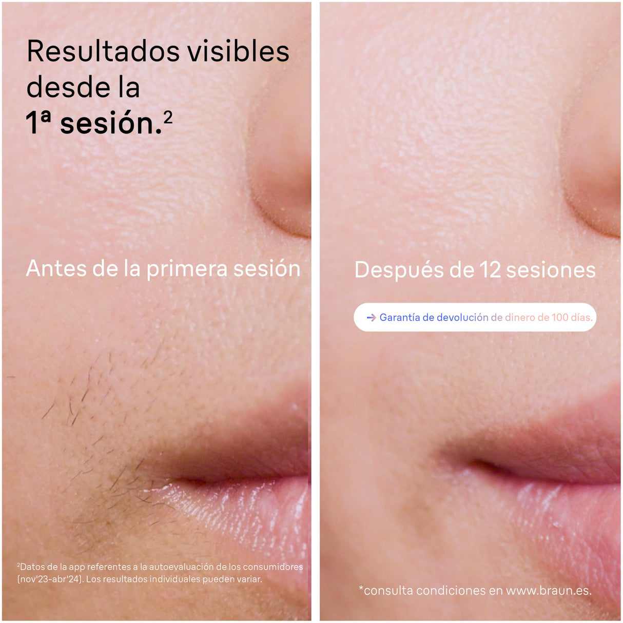 Braun Luz Pulsada Skin i·expert Smart IPL, Eliminación Del Vello En Casa, Alternativa a Depilación Láser Con Inteligencia Artificial, Neceser, Maquinilla Venus, 4 Cabezales Para Cara y Cuerpo, PL7387
