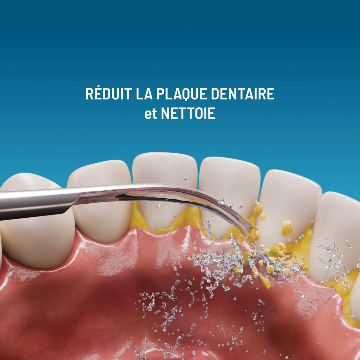 Haepi Julia - Cepillo de dientes eléctrico sónico 3 en 1 | Cepillado + Jet interdental + Descalcificación | 48.000 vibraciones/min | Recargable USB | Para encías sensibles y portadores de aparatos