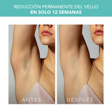 FOREO PEACH 2 IPL, Depiladora Luz Pulsada, Alternativa para Depiladora Laser Mujer, Depiladora Corporal Hombre y Mujer, 10-min de tratamiento, Sistema de Enfriamiento, Cableado, Mint