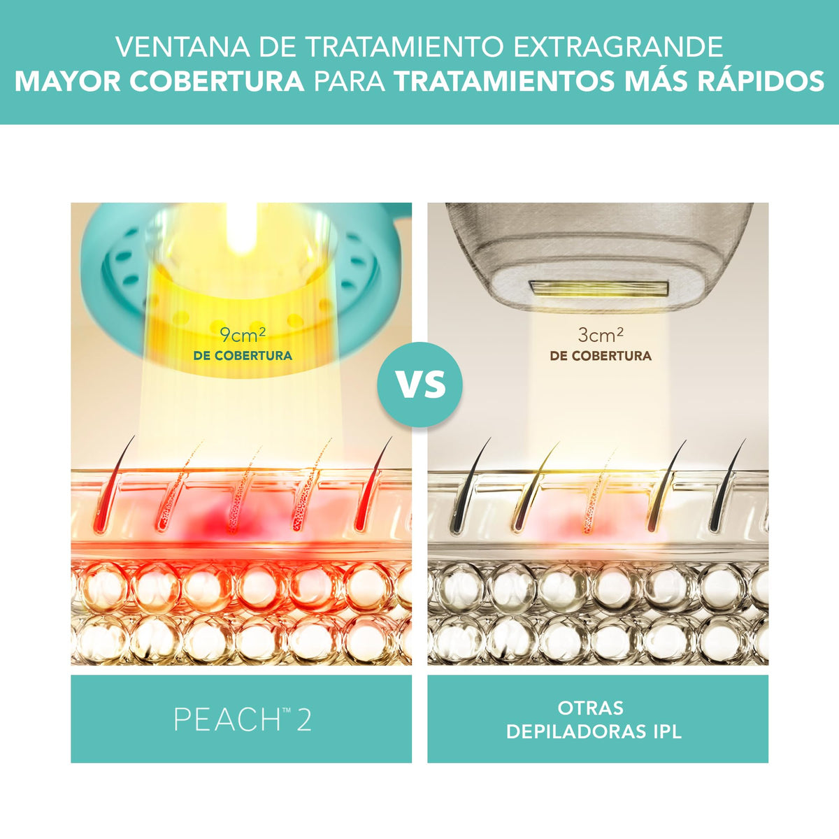 FOREO PEACH 2 IPL, Depiladora Luz Pulsada, Alternativa para Depiladora Laser Mujer, Depiladora Corporal Hombre y Mujer, 10-min de tratamiento, Sistema de Enfriamiento, Cableado, Mint