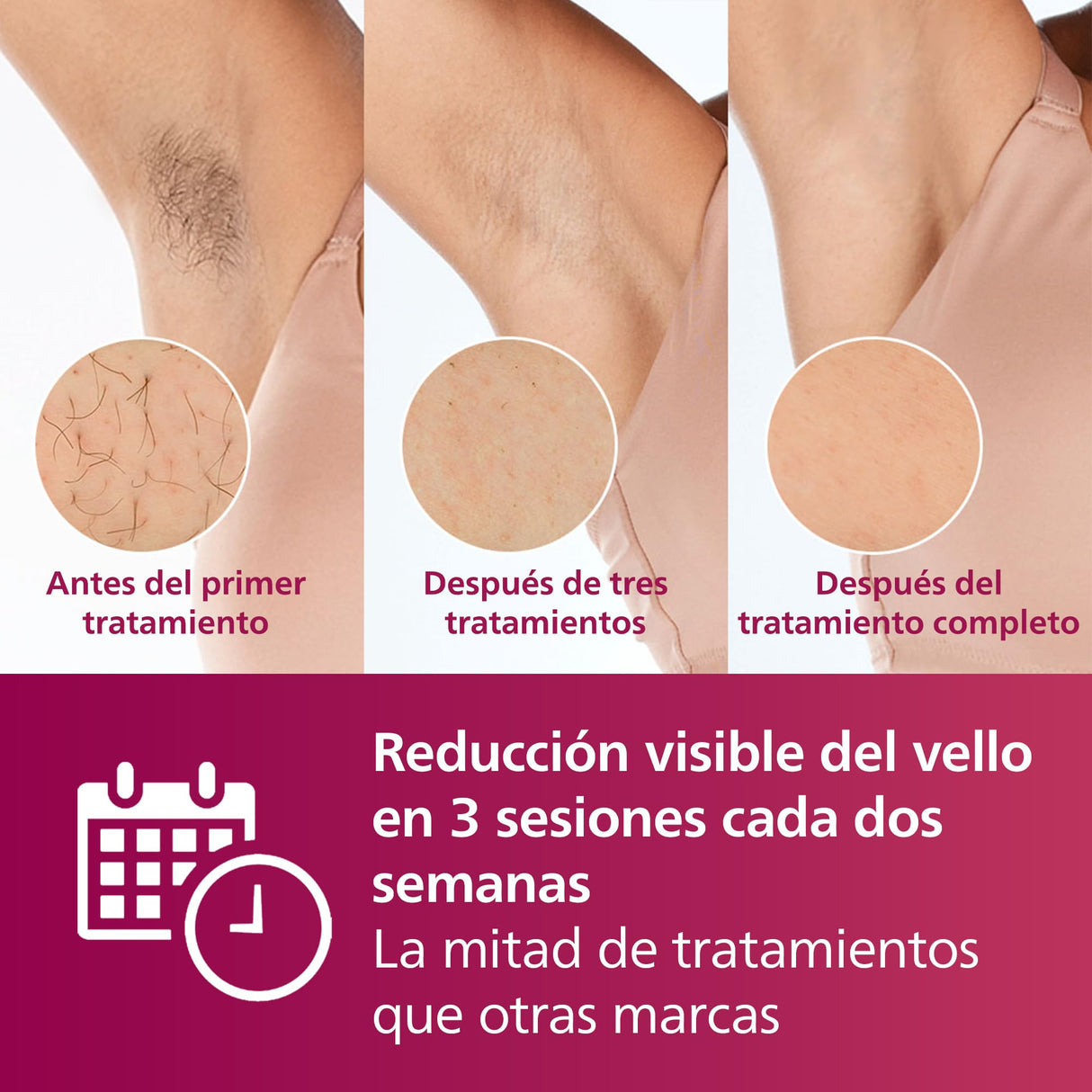 Philips Lumea serie 7000, dispositivo de depilación IPL, alternativa de depilación láser con lápiz recortador compacto satén, 3 accesorios para el cuerpo, la cara y la zona del bikini, BRI923/00