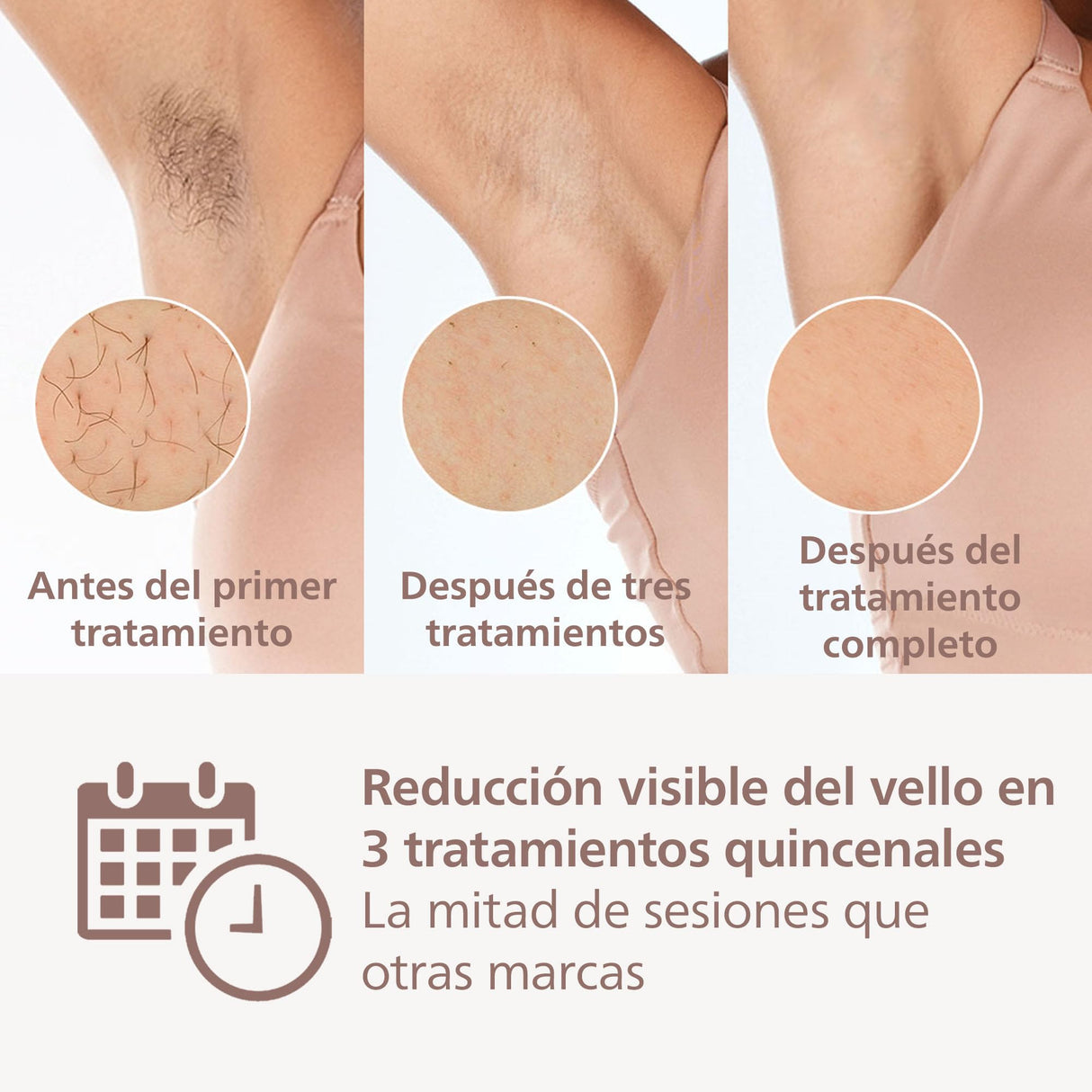 Philips Depiladora Lumea IPL serie 8000 - depilación con tecnología SenseIQ, 2 accesorios para cuerpo y cara, para uso con cable (modelo BRI944/00)