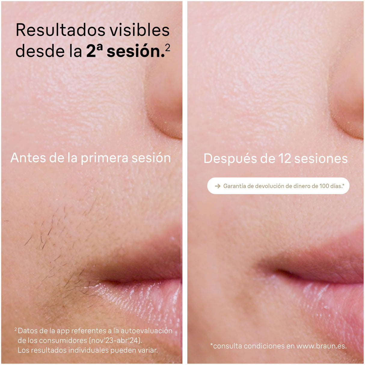 Braun Luz Pulsada Silk-expert Pro 5, Eliminación Del Vello En Casa, Alternativa a Depilación Láser, Depiladora IPL Con Funda, Maquinilla Venus, 4 Cabezales Para Cara y Cuerpo, Blanca/Dorada, PL5342